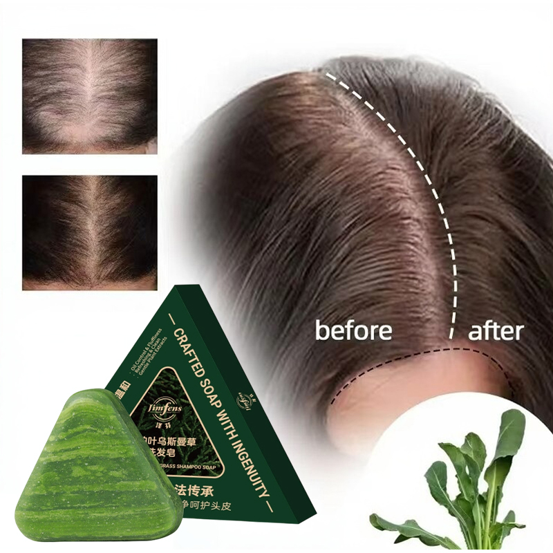 Anti-hair Loss Shampoo Bar! Wi – обзор и цена Bar Soap Shampoo Solid